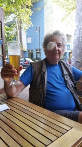 58. Paul met ooglapje. Het ziet er erger uit dan het is.
